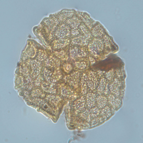 Pollen viewed through a microscope